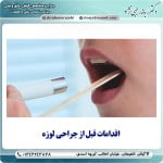 اقدامات قبل از جراحی لوزه