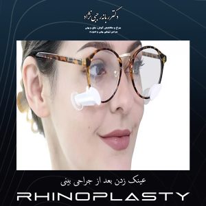 عینک زدن بعد از جراحی بینی