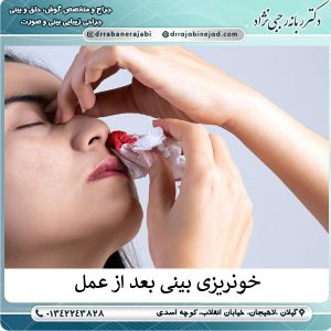 خونریزی بعد از عمل بینی