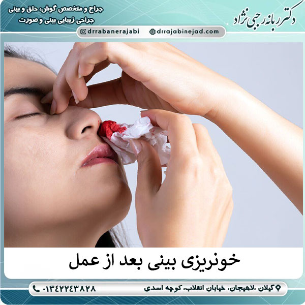 خونریزی بعد از عمل بینی
