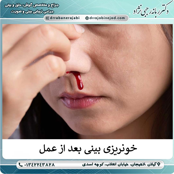 خونریزی بینی بعد از عمل دماغ