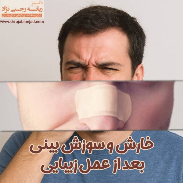 خارش و سوزش بینی بعد از عمل - دکتر ربانه رجبی نژاد
