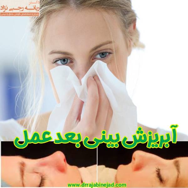 آبریزش بینی بعد عمل بینی - دکتر ربانه رجبی نژاد