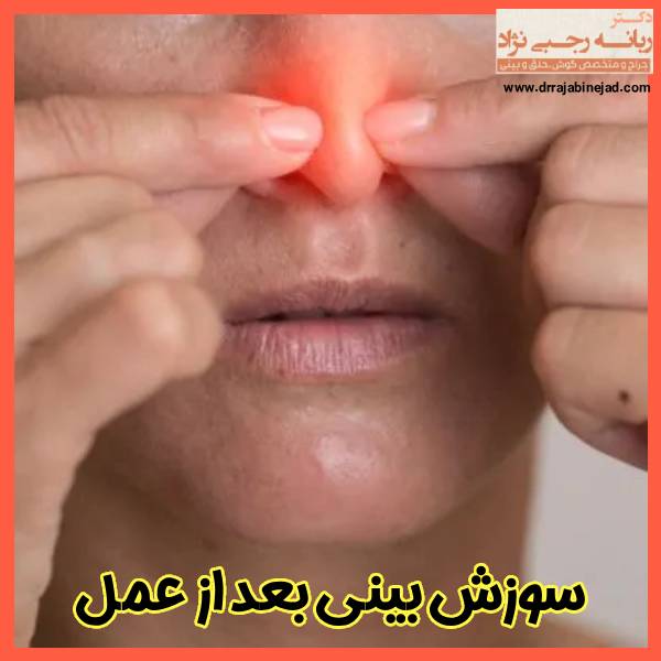 سوزش بینی بعد عمل - دکتر ربانه رجبی نژاد