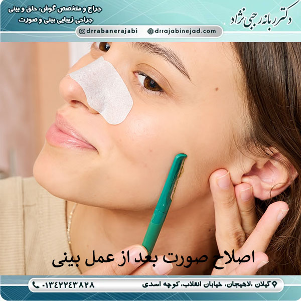 اصلاح صورت بعد از عمل بینی